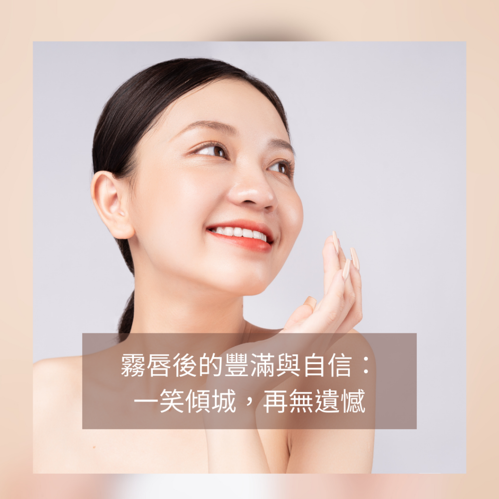 紋唇 霧唇-紋唇-霧唇